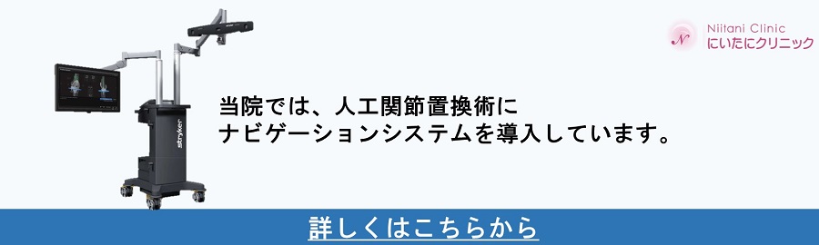 人工関節置換術 ナビゲーションシステム.jpg